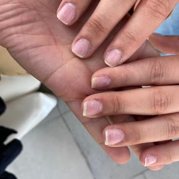 Protez Tırnak Çıkarımı Sonrası Tırnaklarda Hasar Ve Ek Ücret Alınması