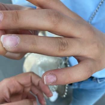 Protez Tırnak Çıkarımı Sonrası Tırnaklarda Hasar Ve Ek Ücret Alınması