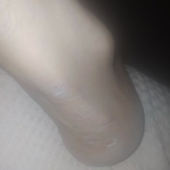 Aldığım Ayakkabının Yarattığı Sorunlara FLO Mağazasından Çözüm Bulamadım