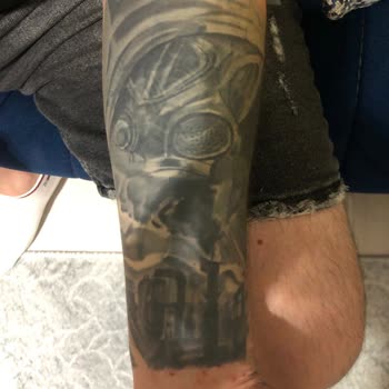 Yüksek Ücret Ödedim, Dövmem Bozuldu Ve Çözüm Sunulmadı