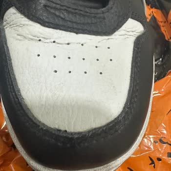 Kısa Sürede Açılan Dikişler Ve Red Edilen Garanti Talebi Mağduriyeti