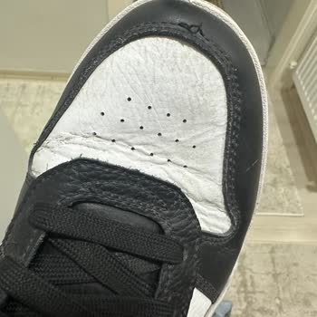 Kısa Sürede Açılan Dikişler Ve Red Edilen Garanti Talebi Mağduriyeti