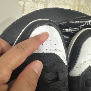 Kısa Sürede Açılan Dikişler Ve Red Edilen Garanti Talebi Mağduriyeti