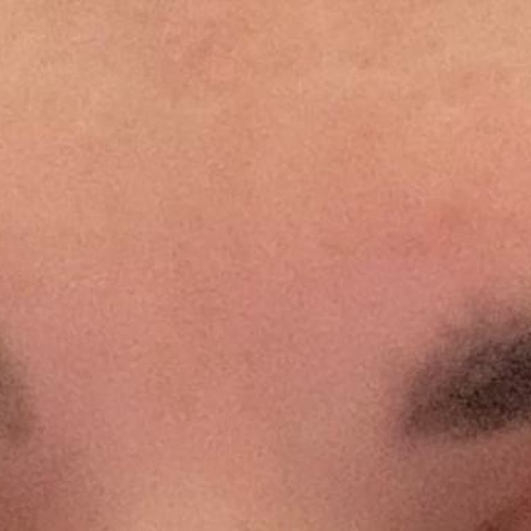 Isana Kaş Boyası Renk Uyumsuzluğu Ve Ciltte Rahatsızlık