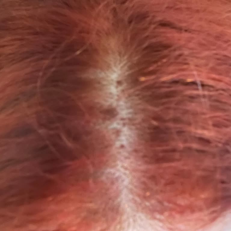 Kozmopol Kozmetik Omega Plus Saç Boyası Kızarıklık Ve Ambalaj Sorunu