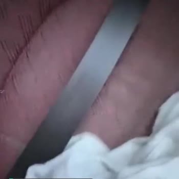 Metro Turizm Kırık Koltuk Rezaleti