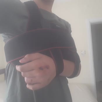 RKS RD5 Bisikletin Gidon Arızası Nedeniyle Yaşanan Kaza Ve Mağduriyet