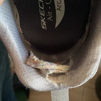 Kısa Sürede Deforme Olan Skechers Ayakkabı İçin Ücret İadesi Talebi