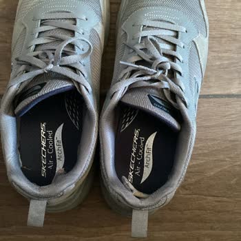 Kısa Sürede Deforme Olan Skechers Ayakkabı İçin Ücret İadesi Talebi