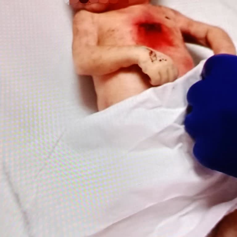 Küvöz Eksikliği Ve İlgisizlik Nedeniyle Bebeğimi Kaybettim