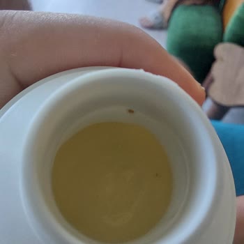 Aldığım Saç Kreminde Çürümüş Ve Kirli Noktalar Çıktı