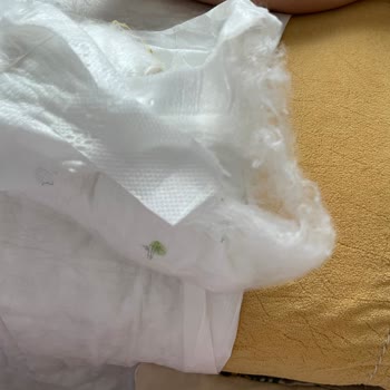 Sleepy 5 Numara Bebek Bezinde Tekrarlayan Tüylenme Sorunu