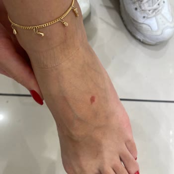 Kısa Süreli Kullanımda Ayağımda Yaraya Sebep Olan Terlik İçin İade Talebim Reddedildi