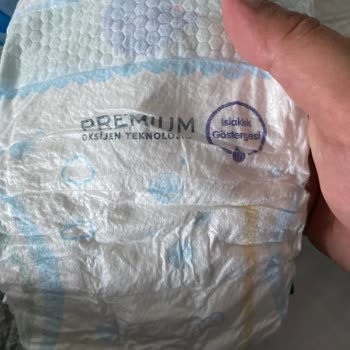 Molfix 3 Numara Bezlerde Farklı İçerik Sorunu Ve Müşteri Hizmetlerine Ulaşamama