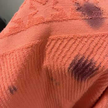 Stop Leke Çıkarıcı Renk Değiştirdi, Kıyafetlerim Zarar Gördü