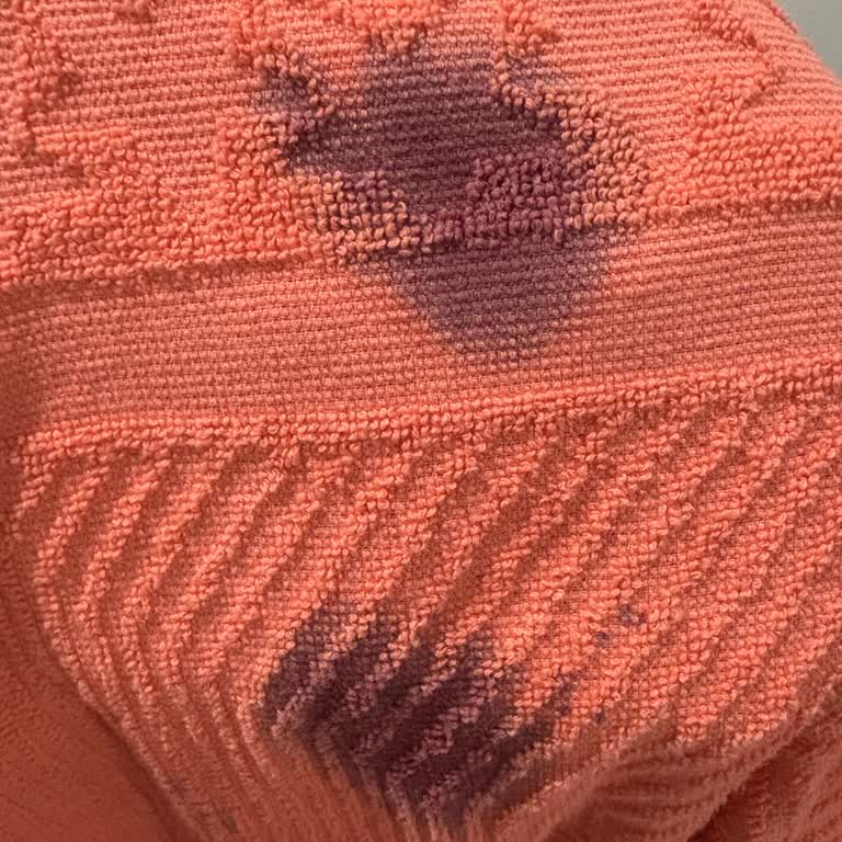 Stop Leke Çıkarıcı Renk Değiştirdi, Kıyafetlerim Zarar Gördü