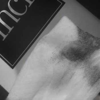 Yeni Alınan Terliklerde Çatlama Ve Boya Sorunu Mağduriyeti