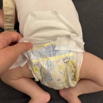 Molfix Bebek Bezi Gaita Sızıntısı ve Kıyafetlerin Kirlenmesi Sorunu