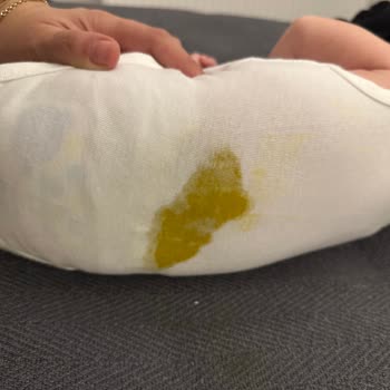 Molfix Bebek Bezi Gaita Sızıntısı ve Kıyafetlerin Kirlenmesi Sorunu