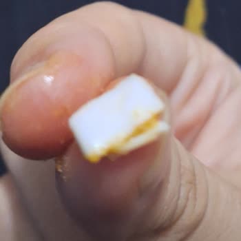 Aldığım Cips Fıstıktan Plastik Parça Çıktı, Sağlığım Tehlikeye Girdi