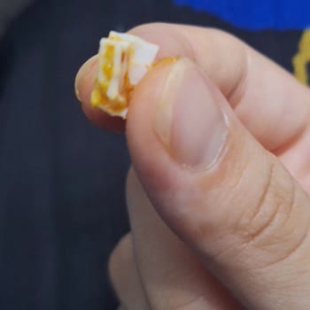Aldığım Cips Fıstıktan Plastik Parça Çıktı, Sağlığım Tehlikeye Girdi