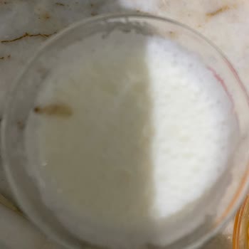 Satın Alınan Sütün İçinden Kurt Çıkması Ve Hijyen Sorunu