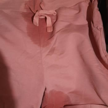 Bagajda Sıvı Ürün Nedeniyle Eşya Zararının Giderilmesi Talebi