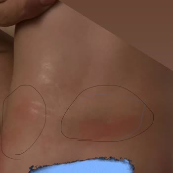 Yeni Seri Sleepy Bebek Bezi Hem Küçük Hem De Cilt Sorununa Yol Açtı