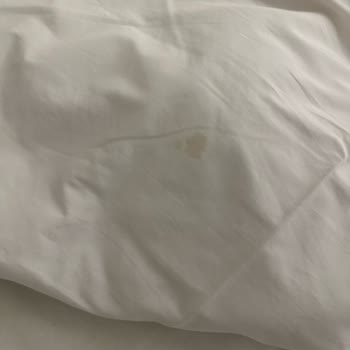 Mısır Turunda Hijyen Skandalı Kötü Otel Ve İlgisiz Firma Mağduriyeti