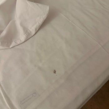 Mısır Turunda Hijyen Skandalı Kötü Otel Ve İlgisiz Firma Mağduriyeti