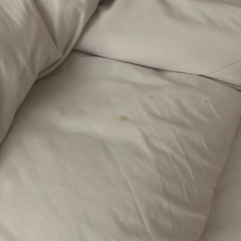 Mısır Turunda Hijyen Skandalı Kötü Otel Ve İlgisiz Firma Mağduriyeti