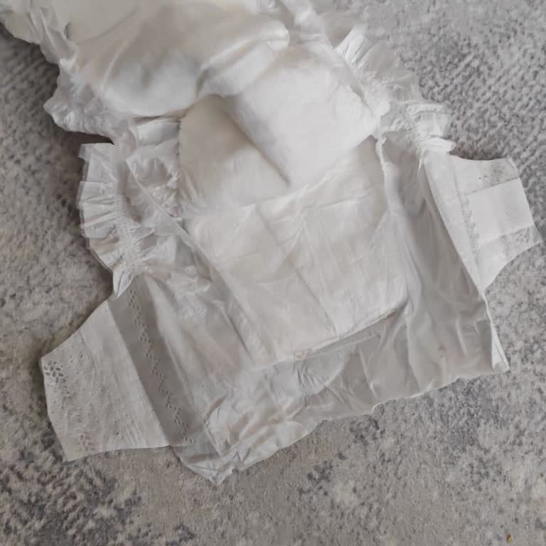 Aldığım Bebek Bezlerinde Cırt Eksikliği Ve İlgisizlik Sorunu