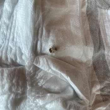 Bebek Bezi Ürününde Hijyen Endişesi ve Üretim Hatası