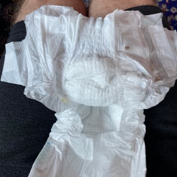 Bebek Bezi Ürününde Hijyen Endişesi ve Üretim Hatası