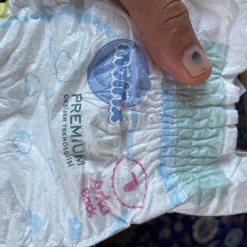 Bebek Bezi Ürününde Hijyen Endişesi ve Üretim Hatası