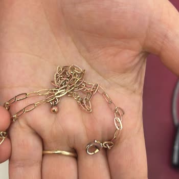 Çelik Diye Satılan Kolye Cildimi Tahriş Etti, Satıcıdan Yanıt Yok!