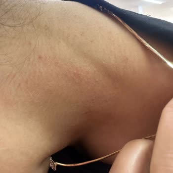 Çelik Diye Satılan Kolye Cildimi Tahriş Etti, Satıcıdan Yanıt Yok!