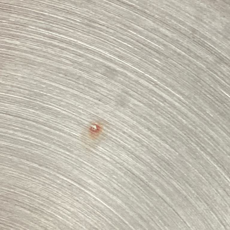 Emsan Çaydanlıkta Kısa Sürede Paslanma ve Garanti Mağduriyeti