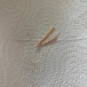 Konserve Hindi Tandırda Ahşap Parçası Çıktı, Sağlığım Tehlikeye Girdi