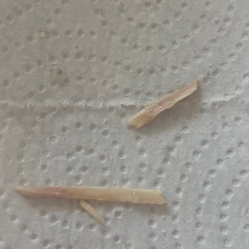 Konserve Hindi Tandırda Ahşap Parçası Çıktı, Sağlığım Tehlikeye Girdi