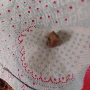 Kuruyemişten Çıkan Taş Dişimi Kırdı Mağduriyetimin Giderilmesini İstiyorum