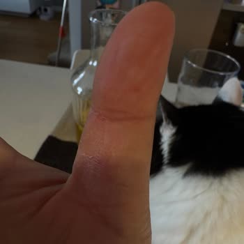 Sebze Ve Meyvelerle Kimyasal Ürün Aynı Poşette, Sızma Sonucu Sağlık Riski Yaşadım