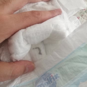 Molfix Bebek Bezinde Yabancı Madde Ve İlgisiz Müşteri Hizmetleri Mağduriyeti