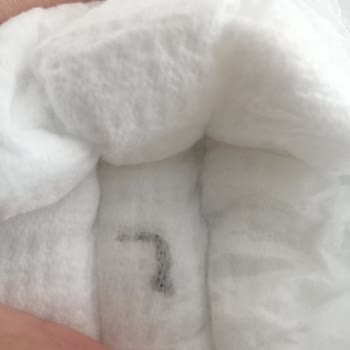 Molfix Bebek Bezinde Yabancı Madde Ve İlgisiz Müşteri Hizmetleri Mağduriyeti