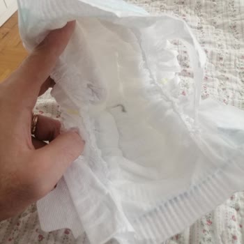 Molfix Bebek Bezinde Yabancı Madde Ve İlgisiz Müşteri Hizmetleri Mağduriyeti