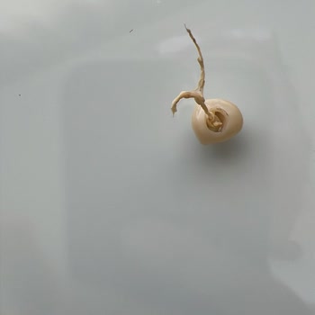 Yapılan Zirkon Diş Bir Yıl Dolmadan Düştü, Baş Ağrısı Ve İlgisizlik Yaşadım