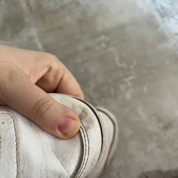 3 Ayda Deforme Olan Adidas Çocuk Ayakkabısı Hayal Kırıklığı