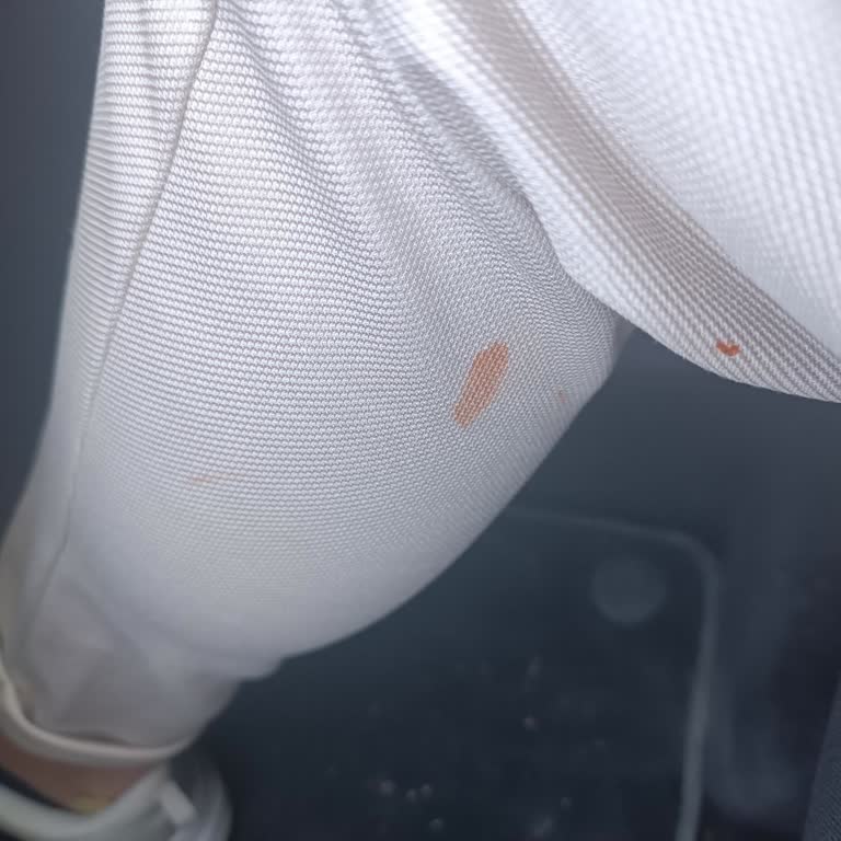 Köfteci Yusuf'ta Hayal Kırıklığı Ve Zarar Gören Kıyafetlerim