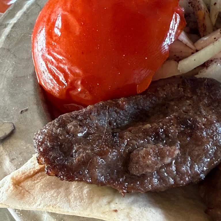 Yemeğimde Kıl Çıktı Hijyen Ve İlgi Yetersizdi