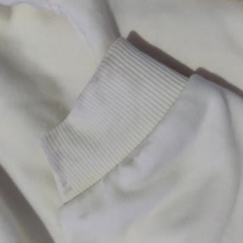 Lekeli Ürün Gönderildi, İade Talebim Karşılanmıyor